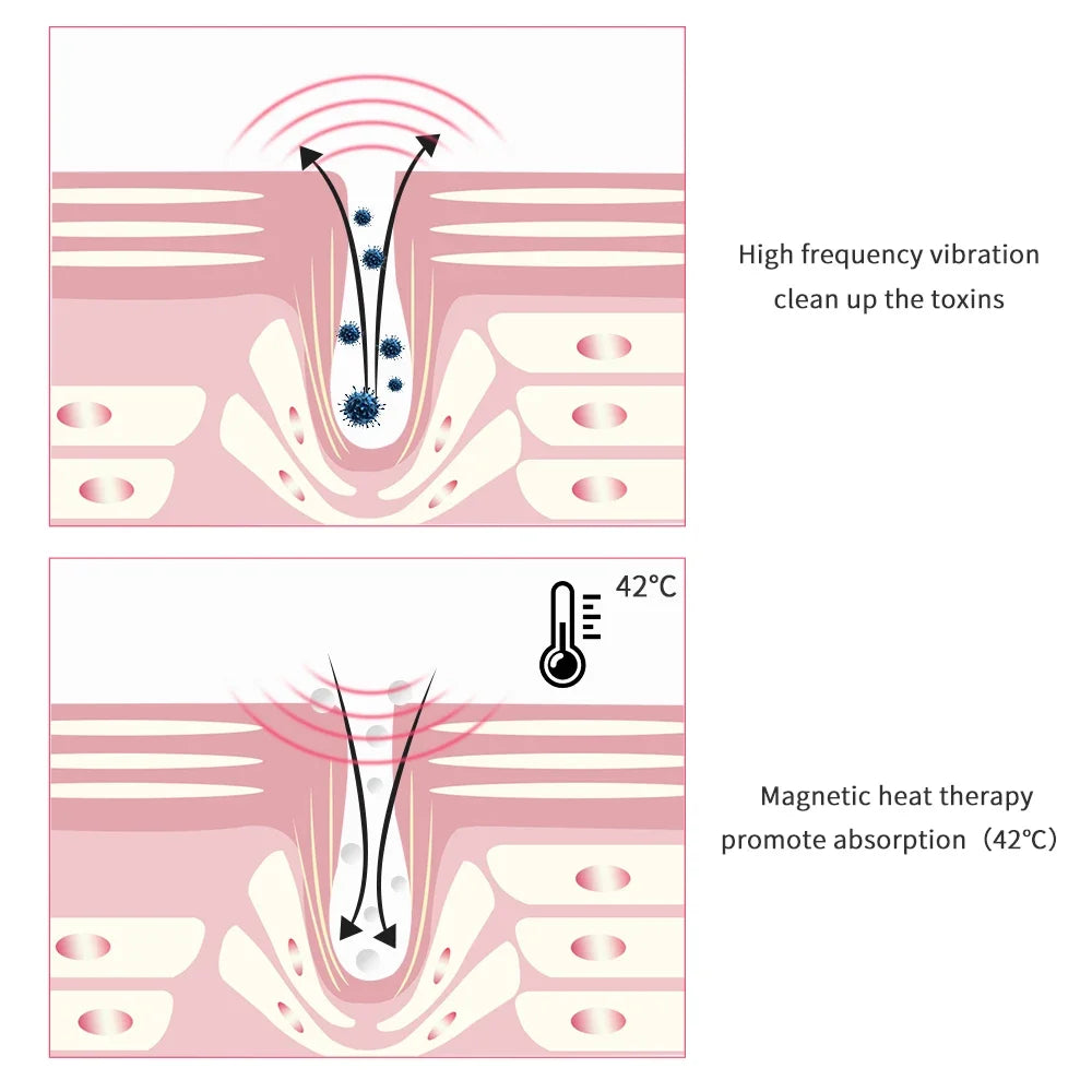 Heating Therapy Ions Mini Eye Massager Anti-Ageing Wrinkle Dark Circle - Buy Gifts 4 You by NX3